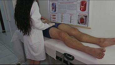 Nurse Observes Patient's Erection