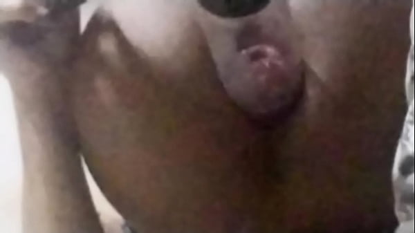 Rich Prolapse