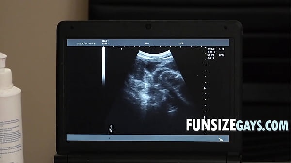 Download Video - Anal X Ray Vision