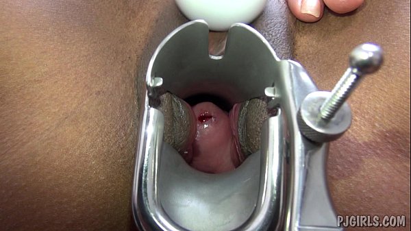 Gynécologue Masturbation