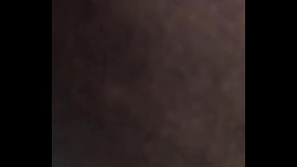 Leg