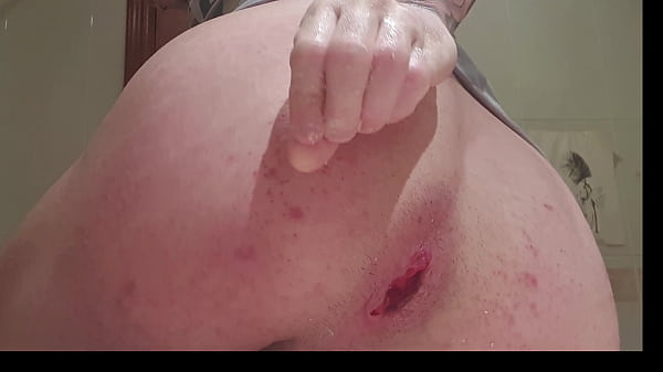 Self fist asshole