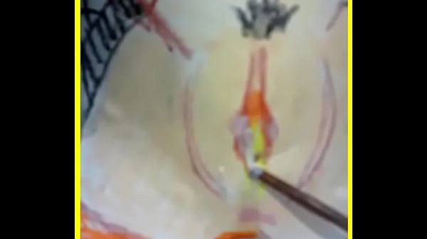 Doctor SEX, don't sperm!
