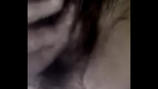 Hairy 00 3742 3914 1490 8016 2363