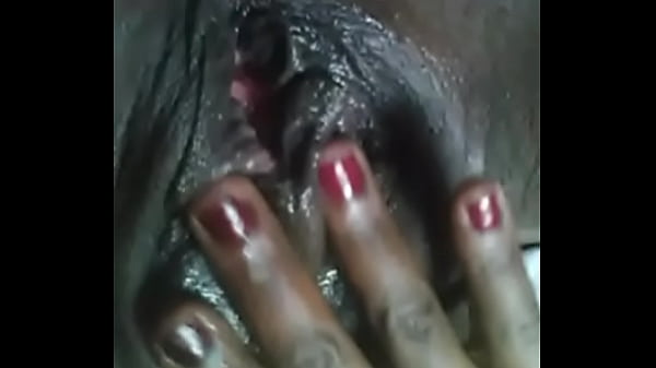 s.-3885427627505000155