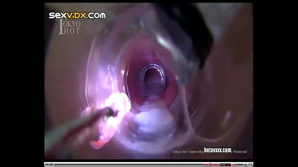 Jap chick get cum in her ass via pump (by Balbitos)