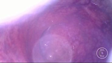 Look deep inside my ass!