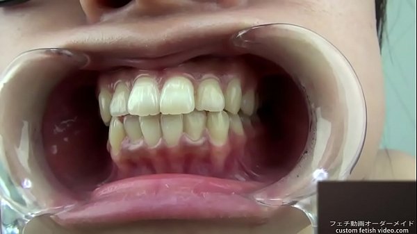 A woman shows her gums and sputs saliva