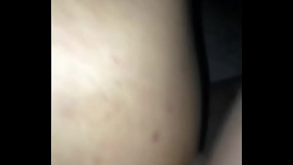 thumb b