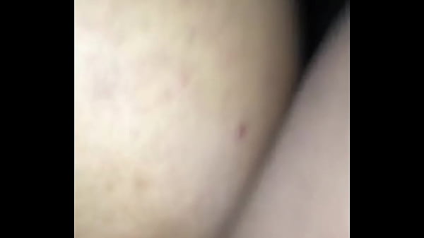 thumb b