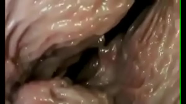 thumb penetration documentary