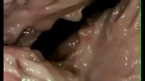 thumb penetration documentary