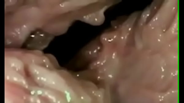 thumb penetration documentary