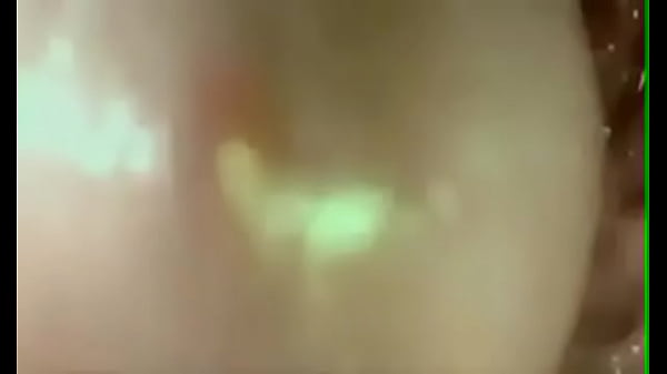 thumb penetration documentary