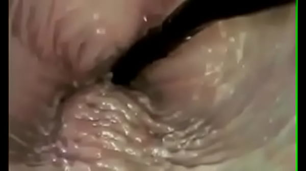 thumb penetration documentary