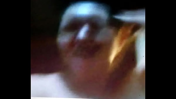 thumb asms