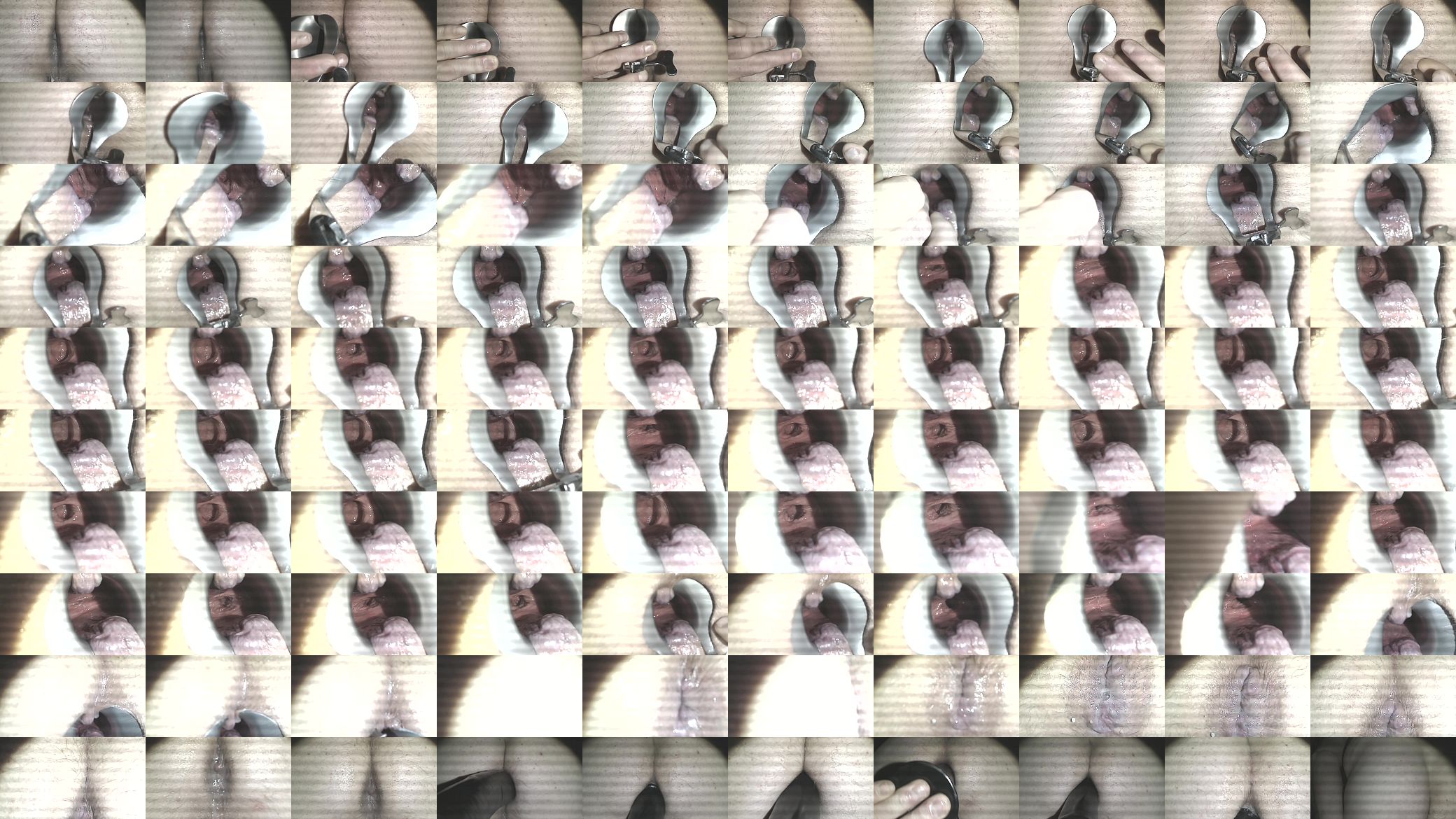 Video 7205A   closeup of my asshole deep inside 预览图