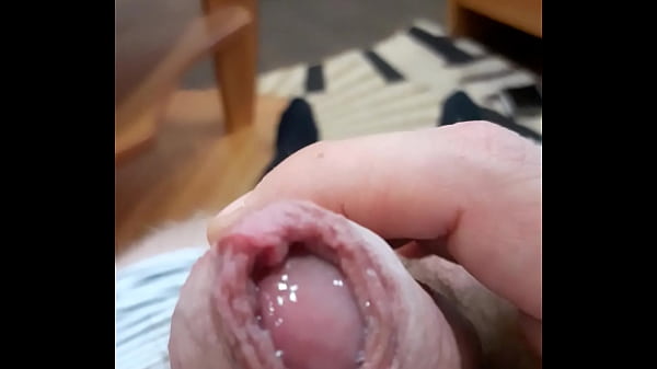 Dick
