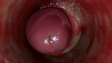 Camera Inside Deep Pussy Captures Huge Ejaculation of Sperm ASMR