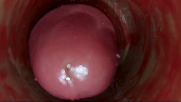 Download Video - Camera Inside Deep Pussy Captures Huge Ejaculation of Sperm ASMR