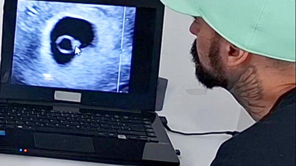 Cuckold takes wife to gynecologist for ultrasound.