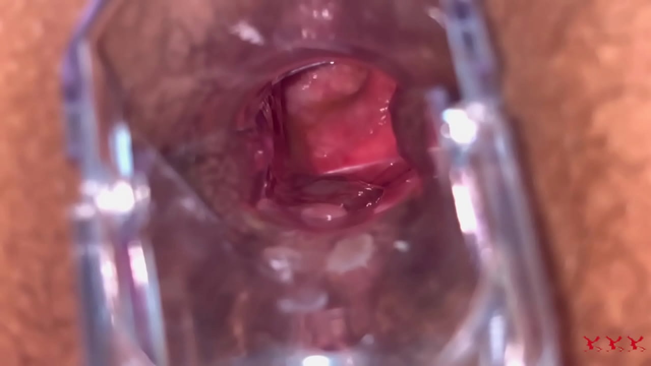 Espéculo de visión anal
                    sexy ass homemade booty legs huge ass bbw bush culona cellulite big butt natural tits fat ass anal slut wide hips mature anal thick body real ass intense anal tight anal gape voluptous body muchos negros