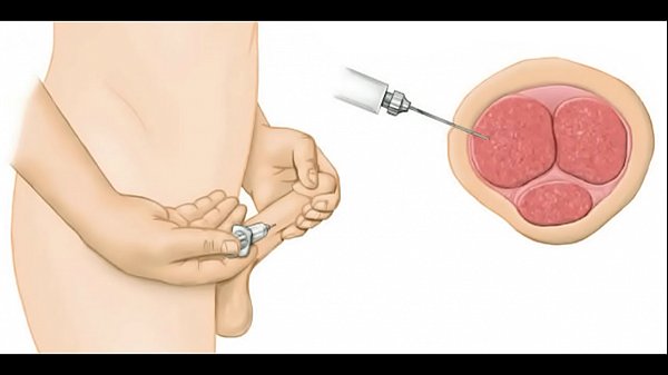 Voulez-Vous La Faire Venir? Avoir Le Meilleur Orgasme De Sa Vie?