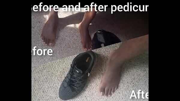 Before and after pedicure