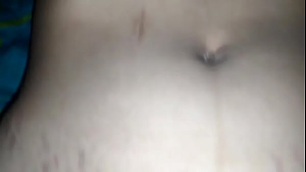 thumb x1