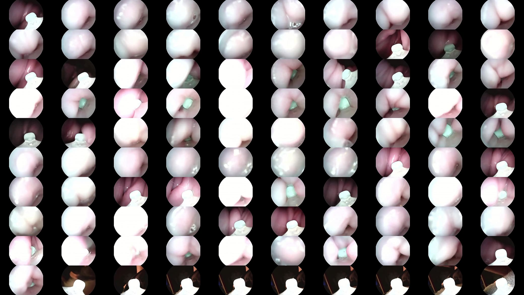 Camera in fertile cervix 预览图