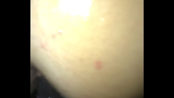 My oily ass