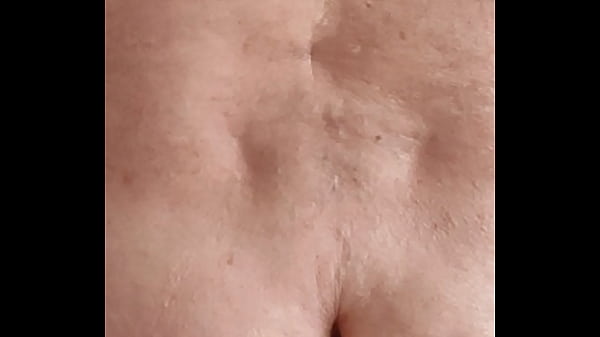 Kalle mit 2 dicken Knubbels die einen Durchmess...