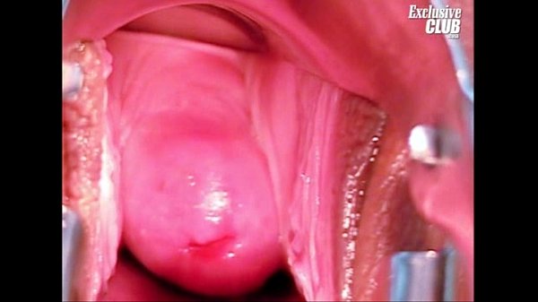 Download Video - Tera Joy pussy gyno gaping at clinic by old doctor