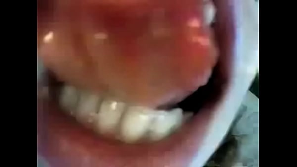 thumb b butt cam