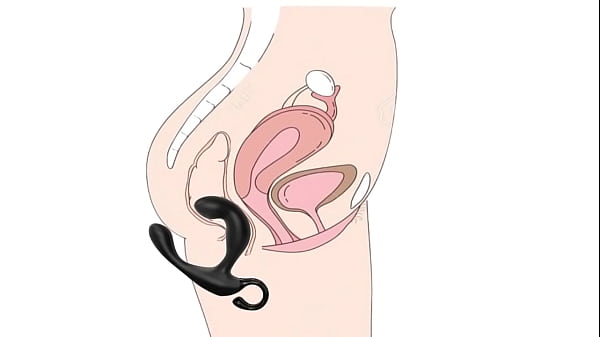 Estimulacion Rectal
