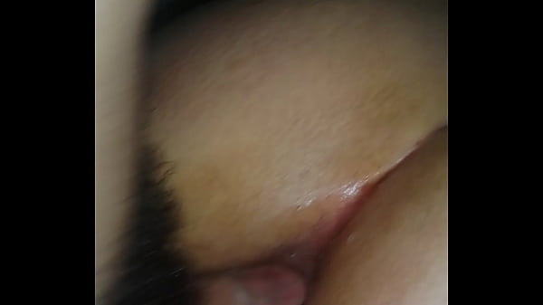 阿根廷的自制肛门