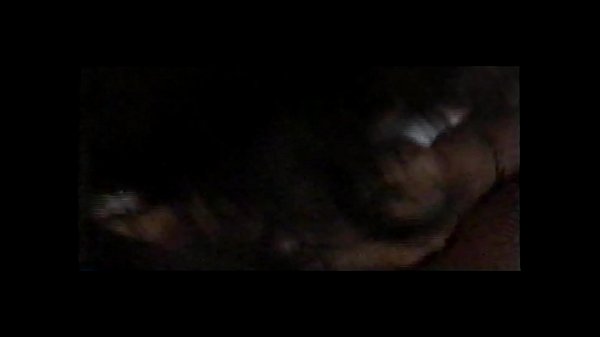 thumb extra