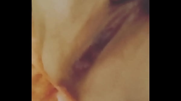 thumb suddenly like