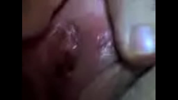 thumb 331