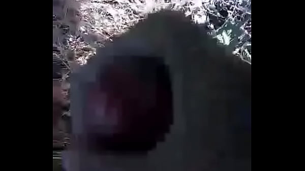 It burns and it is on your lover and it is fire on him