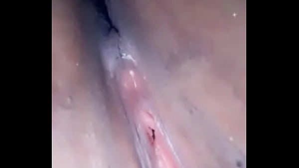 thumb exit