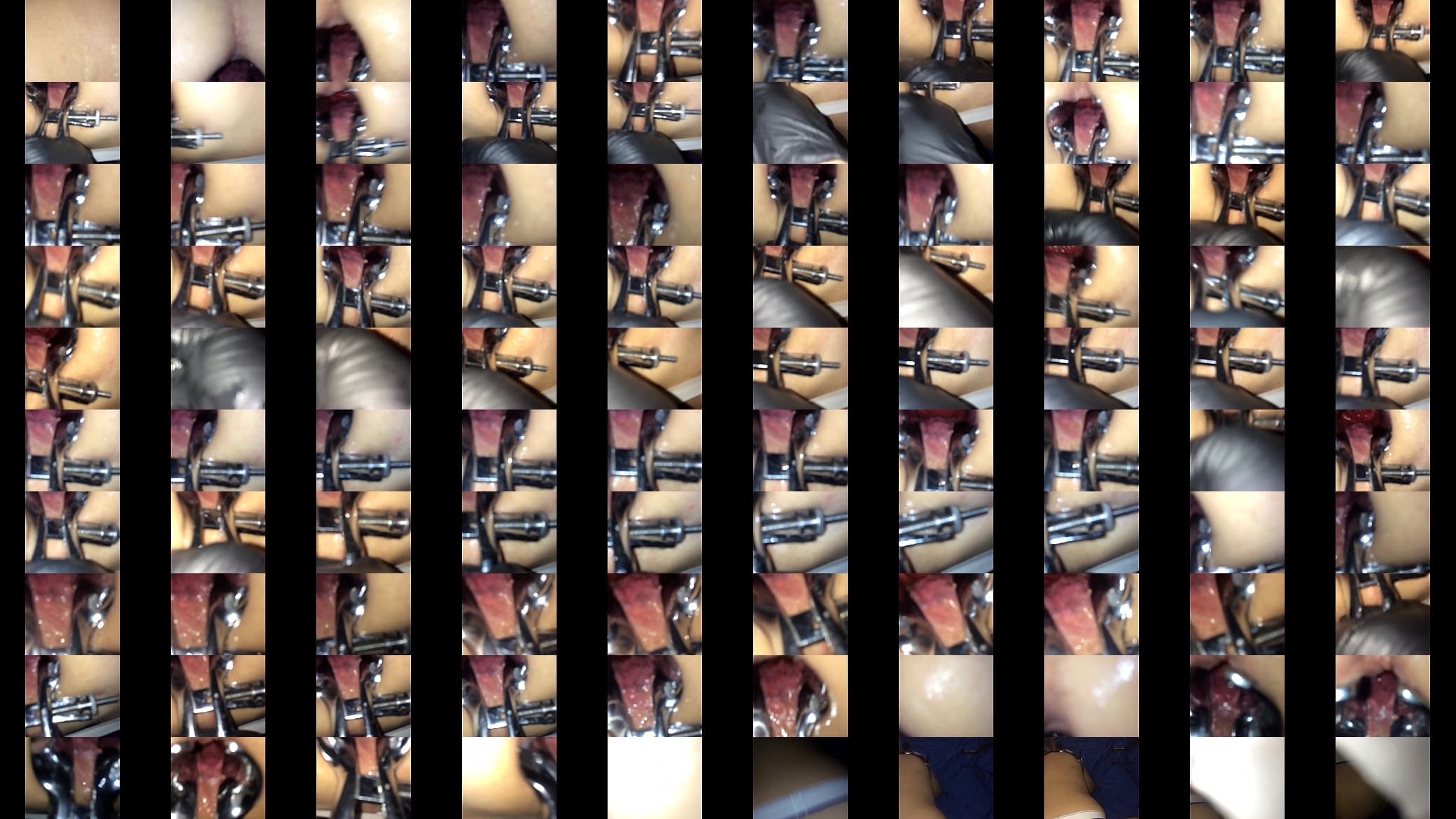 Shemale used speculum on me 预览图