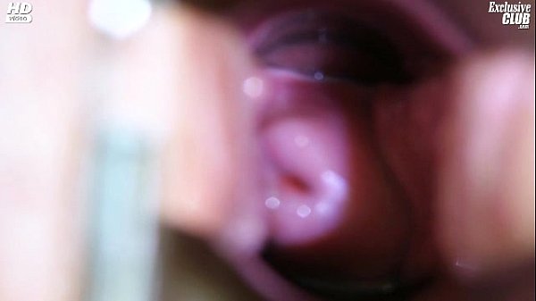 Download Video - Candie visiting her gyno doctor for pussy speculum gyno