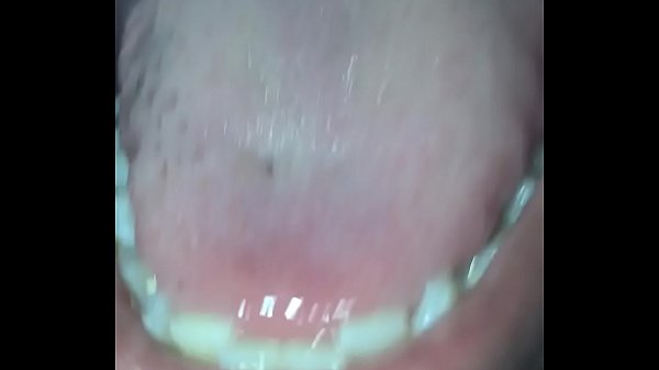 Bouche 4