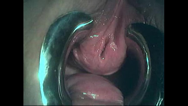 Download Video - BDSM&period; Fingering girl's urethra