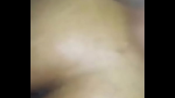 thumb burning std