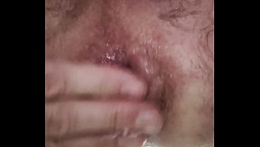 Anal whore practices rosebud and prolapse and f...