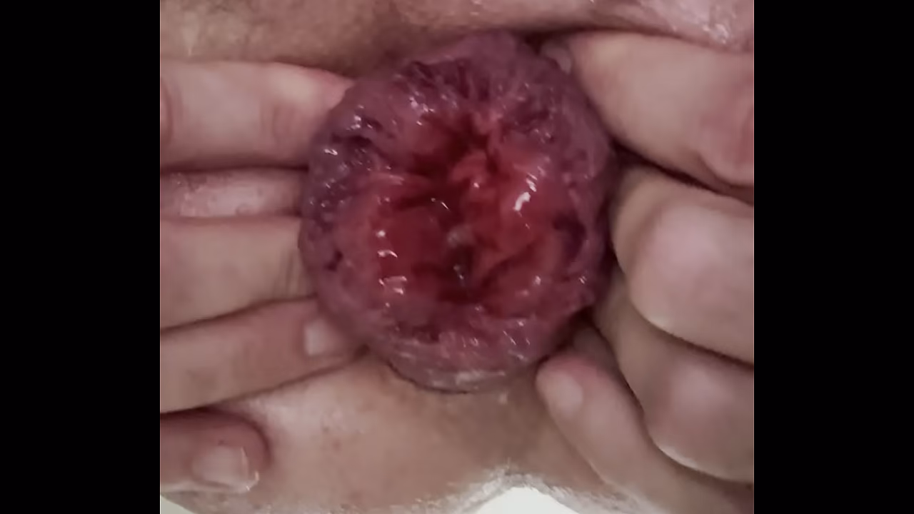 Anal whore practices rosebud and prolapse and fisting