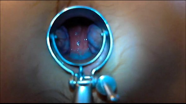 Download Video - speculum play 8 min