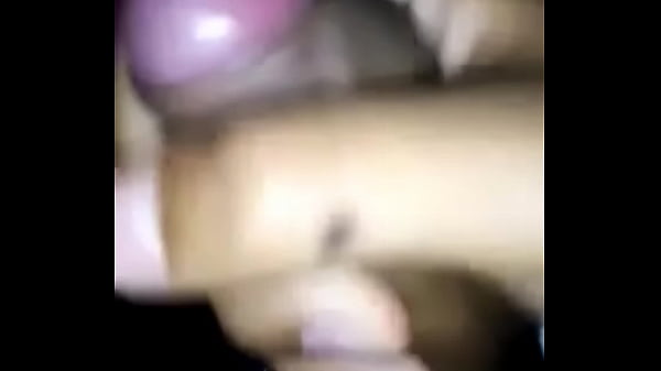 Jeune Fille Avec Une Jambe Dure Et Grosse Pour Son Petit Âge